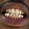 Gold Grillz Miami Call/Text 305.989.6479 www.GoldTeethMiami.com