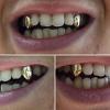 Gold Grillz Miami Call/Text 305.989.6479 www.GoldTeethMiami.com