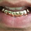 Gold Grillz Miami Call/Text 305.989.6479 www.GoldTeethMiami.com