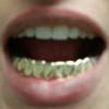 Gold Grillz Miami Call/Text 305.989.6479 www.GoldTeethMiami.com