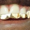 Gold Grillz Miami Call/Text 305.989.6479 www.GoldTeethMiami.com