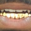 Gold Grillz Miami Call/Text 305.989.6479 www.GoldTeethMiami.com