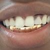 Gold Grillz Miami Call/Text 305.989.6479 www.GoldTeethMiami.com