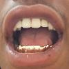 Gold Grillz Miami Call/Text 305.989.6479 www.GoldTeethMiami.com