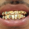 Gold Grillz Miami Call/Text 305.989.6479 www.GoldTeethMiami.com