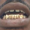 Gold Grillz Miami Call/Text 305.989.6479 www.GoldTeethMiami.com