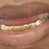 Gold Grillz Miami Call/Text 305.989.6479 www.GoldTeethMiami.com