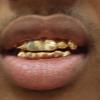 Gold Grillz Miami Call/Text 305.989.6479 www.GoldTeethMiami.com