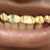 Gold Grillz Miami Call/Text 305.989.6479 www.GoldTeethMiami.com