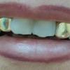 Gold Grillz Miami Call/Text 305.989.6479 www.GoldTeethMiami.com