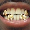 Gold Grillz Miami Call/Text 305.989.6479 www.GoldTeethMiami.com