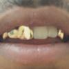 Gold Grillz Miami Call/Text 305.989.6479 www.GoldTeethMiami.com