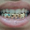 Gold Grillz Miami Call/Text 305.989.6479 www.GoldTeethMiami.com