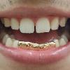 Gold Grillz Miami Call/Text 305.989.6479 www.GoldTeethMiami.com