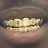 Gold Grillz Miami Call/Text 305.989.6479 www.GoldTeethMiami.com