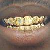 Gold Grillz Miami Call/Text 305.989.6479 www.GoldTeethMiami.com