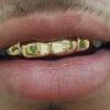 Gold Grillz Miami Call/Text 305.989.6479 www.GoldTeethMiami.com