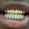 Gold Grillz Miami Call/Text 305.989.6479 www.GoldTeethMiami.com