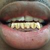 Gold Grillz Miami Call/Text 305.989.6479 www.GoldTeethMiami.com