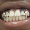 Gold Grillz Miami Call/Text 305.989.6479 www.GoldTeethMiami.com