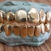 Gold Grillz Miami Call/Text 305.989.6479 www.GoldTeethMiami.com