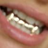 Gold Grillz Miami Call/Text 305.989.6479 www.GoldTeethMiami.com