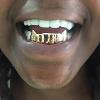 Gold Grillz Miami Call/Text 305.989.6479 www.GoldGrillzMiami.com