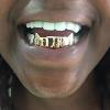 Gold Grillz Miami Call/Text 305.989.6479 www.GoldGrillzMiami.com