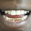 Gold Grillz Miami Call/Text 305.989.6479 www.GoldTeethMiami.com